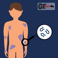 Hanseníase (S13E16)