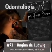 71 #Infecções Odontogênicas - Angina de Ludwig