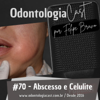 70 #Infecções Odontogênicas: Abscesso e Celulite