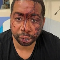 A questão racial ainda é um tabu aqui na França