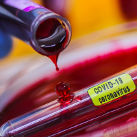 Essa é uma oportunidade de se adaptar diante das mudanças