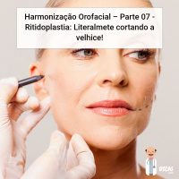 085 Harmonização Orofacial - Parte 07 - Ritidoplastia: Literalmete cortando a velhice!
