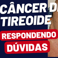 Câncer de Tireoide: Esclarecendo as Dúvidas Mais Comuns