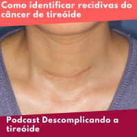 Como identificar recidivas do câncer de tireóide?