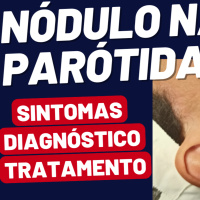 Nódulo na Parótida: Conheça as Opções de Tratamento