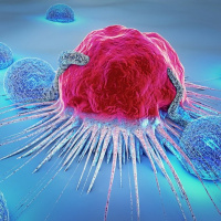 Como saber se um nódulo na tireóide é maligno