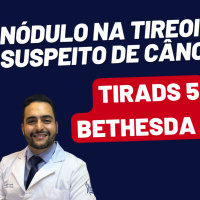 NÓDULO NA TIREOIDE = CÂNCER, COMO SABER? COMO TRATAR?