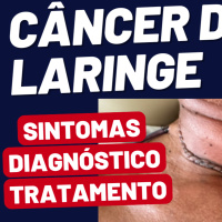Câncer de Laringe: Como Reconhecer os Sintomas e Garantir o Tratamento Correto