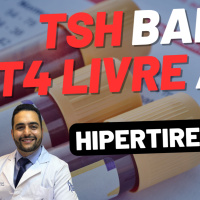 TSH BAIXO, T4 LIVRE ALTO - HIPERTIREOIDISMO POR DOENÇA DE GRAVES