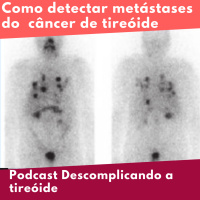 Como detectar metástases do câncer de tireóide
