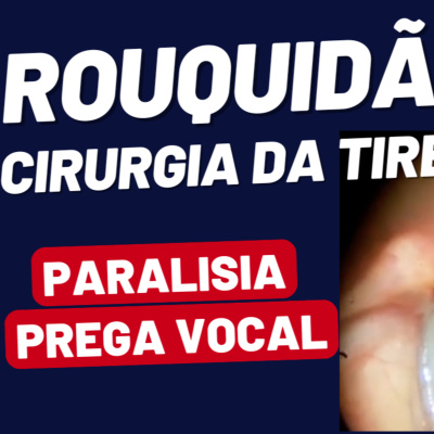 Dr Tireóide Responde