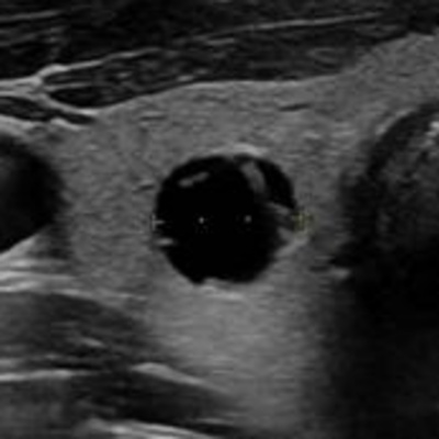 Dr Tireóide Responde