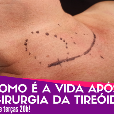 Dr Tireóide Responde