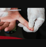 Remissão rara do HIV após transplante de medula indica que a cura é possível, explica médico