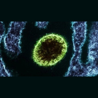 Surto de vírus Nipah na Índia acende alerta entenda