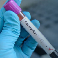 1º caso de Coronavírus é confirmado no Brasil 