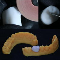 Episódio 85 - Detalhes Anatômicos e Adaptação das Peças Protéticas x Fluxo Digital. A Realidade Clínica com Fernando Feitosa