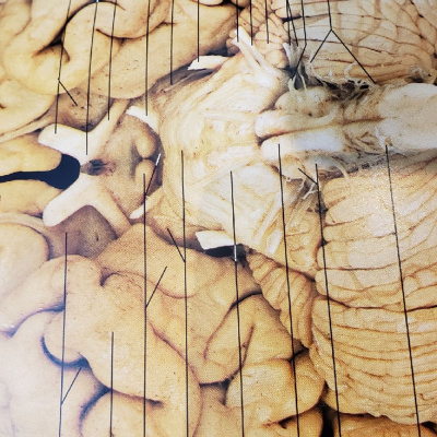 Uma Nova Esperança Para Os Homens